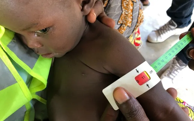 UNICEF calls for action by governments to stop deaths from severe acute malnutrition.