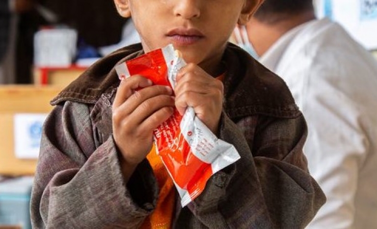 A malnourished child in Yemen with the Ready-to-Use Therapeutic Food.