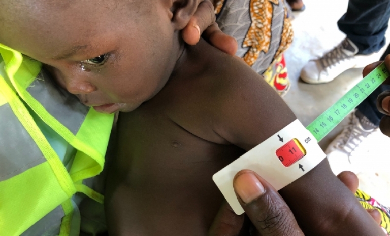 UNICEF calls for action by governments to stop deaths from severe acute malnutrition.